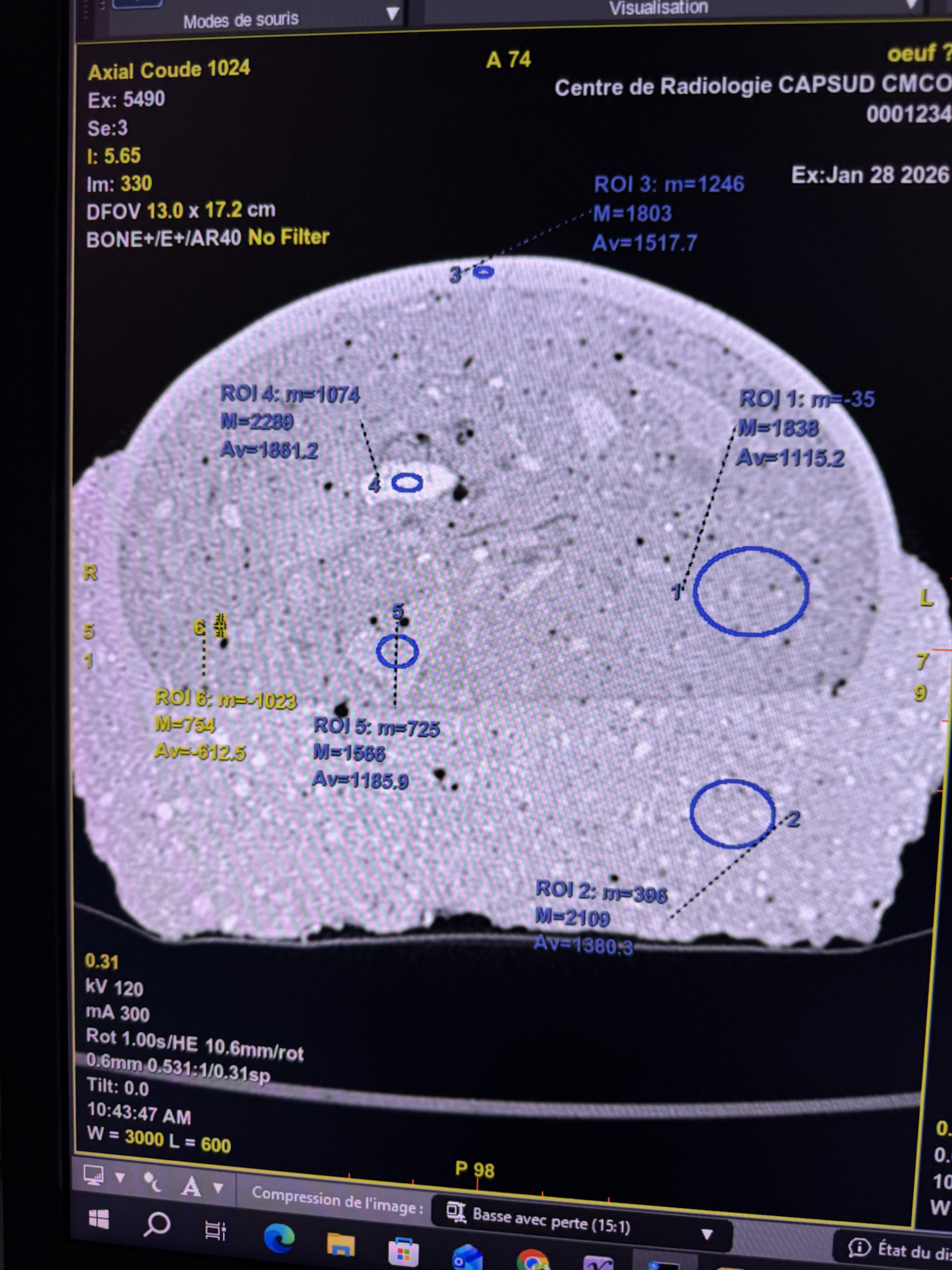 CT scans don’t lie: A surprising fake segnosaur egg! - Is It Real? How ...