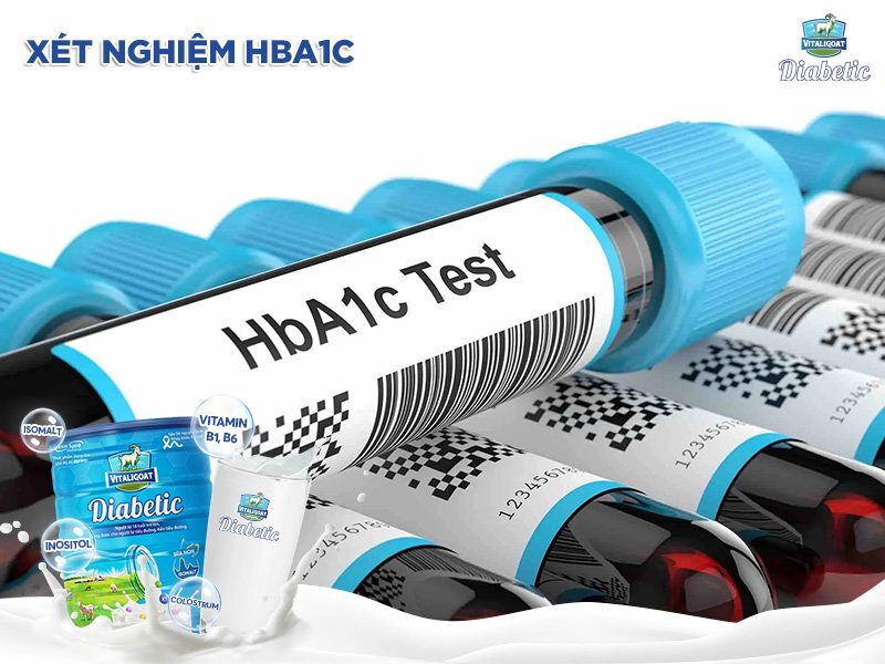 🩺 Xét nghiệm HbA1c: Chìa khóa kiểm soát bệnh tiểu đường hiệu quả! 🧬 ...