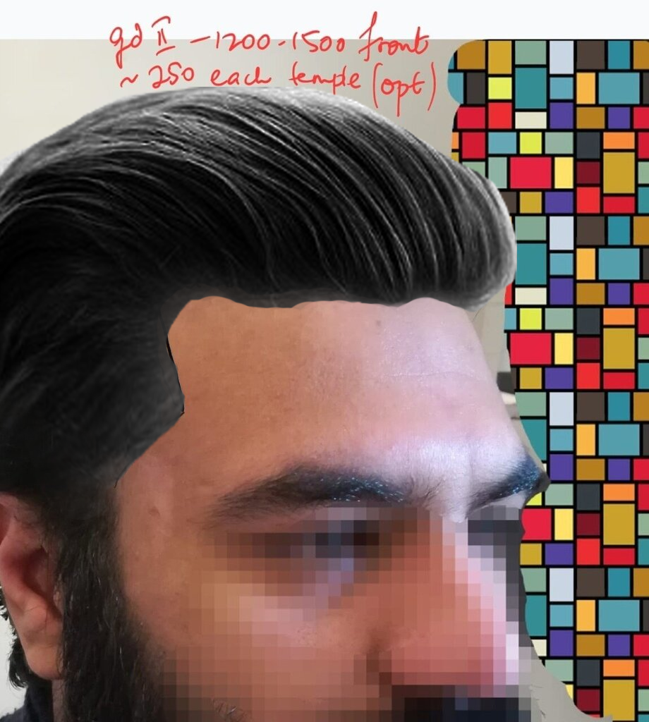 The 