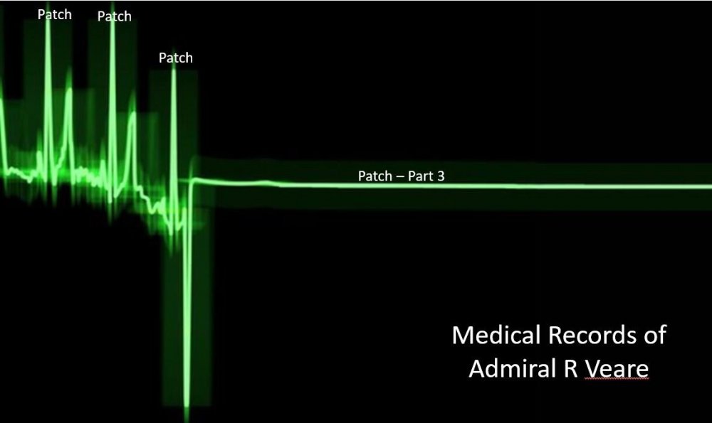 ECG RvR.JPG